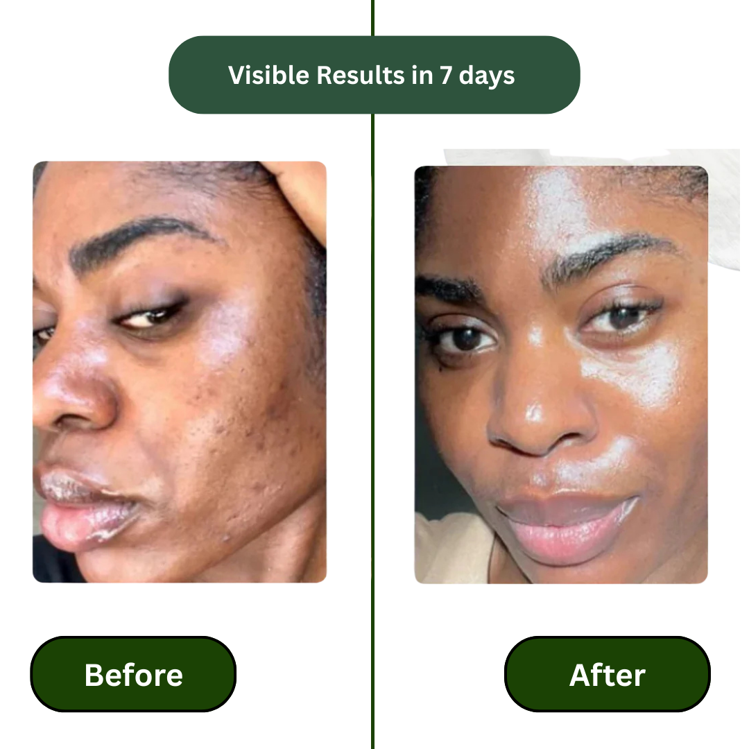 Yiyu Korean Skincare Anti Aging Toner Pads
