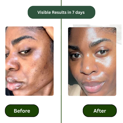 Yiyu Korean Skincare Anti Aging Toner Pads